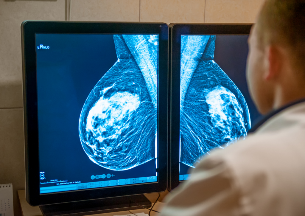 Health care professional reviewing mammogram images on a screen